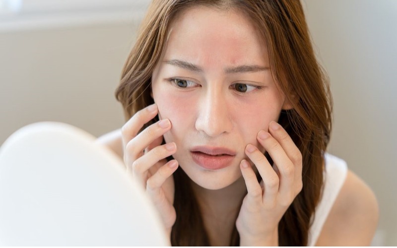 Nóng mặt là điềm gì